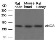 Western blot analysis of extracts from Rat heart, Mouse heart and Rat kidney tissue using eNOS(Ab-1177) Antibody.