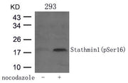 Western blot analysis of extracts from 293 cells untreated or treated with Nocodazol using Stathmin 1(Phospho-Ser16) Antibody.