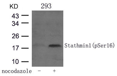 Western blot analysis of extracts from 293 cells untreated or treated with Nocodazol using Stathmin 1(Phospho-Ser16) Antibody.