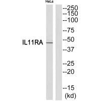 Western blot analysis of extracts from HeLa cells, using IL11RA antibody.
