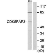 Western blot analysis of extracts from 293 cells, using CDK5RAP3 antibody.