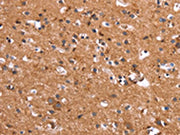 The image on the left is immunohistochemistry of paraffin-embedded Human brain tissue using CSB-PA044365(HSD17B1 Antibody) at dilution 1/40, on the right is treated with synthetic peptide. (Original magnification: ×200)