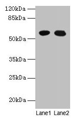 Western blot All lanes: GTPBP6 antibody at 6µg/ml Lane 1: A549 whole cell lysate Lane 2: Hela whole cell lysate Secondary Goat polyclonal to rabbit IgG at 1/10000 dilution Predicted band size: 57 kDa Observed band size: 57 kDa