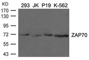 Western blot analysis of extracts from 293, JK, p19 and K-562 cells using ZAP70(Ab-292) Antibody.