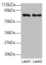 Western blot All lanes: TAX1BP3 antibody at 2µg/ml Lane 1: EC109 whole cell lysate Lane 2: 293T whole cell lysate Secondary Goat polyclonal to rabbit IgG at 1/15000 dilution Predicted band size: 14 kDa Observed band size: 70 kDa