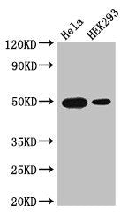 Western Blot Positive WB detected in: Hela whole cell lysate, HEK293 whole cell lysate All lanes: JUND antibody at 3µg/ml Secondary Goat polyclonal to rabbit IgG at 1/50000 dilution Predicted band size: 36 kDa Observed band size: 50 kDa
