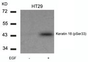 Western blot analysis of extracts from HT29 cells untreated or treated with EGF using Keratin 18(Phospho-Ser33) Antibody.