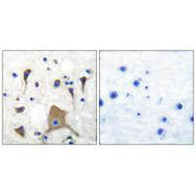Immunohistochemical analysis of paraffin-embedded human brain tissue using GluR5 antibody.