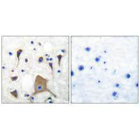 Immunohistochemical analysis of paraffin-embedded human brain tissue using GluR5 antibody.
