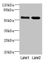 Western blot All lanes: EFCAB14 antibody at 4µg/ml Lane 1: Colo320 whole cell lysate Lane 2: Hela whole cell lysate Secondary Goat polyclonal to rabbit IgG at 1/10000 dilution Predicted band size: 56 kDa Observed band size: 56 kDa