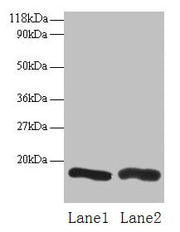 Western blot All lanes: CHMP2A antibody at 2µg/ml Lane 1: EC109 whole cell lysate Lane 2: 293T whole cell lysate Secondary Goat polyclonal to rabbit IgG at 1/15000 dilution Predicted band size: 26 kDa Observed band size: 16 kDa