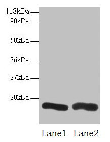 Western blot All lanes: CHMP2A antibody at 2µg/ml Lane 1: EC109 whole cell lysate Lane 2: 293T whole cell lysate Secondary Goat polyclonal to rabbit IgG at 1/15000 dilution Predicted band size: 26 kDa Observed band size: 16 kDa