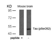 Western blot analysis of extracts from mouse brain tissue using Tau(Phospho-Ser262) Antibody and the same antibody preincubated with blocking peptide.