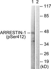 Western blot analysis of extracts from COS7 cells treated with Etoposide using Arrestin 1 (Phospho-Ser412) Antibody.The lane on the right is treated with the antigen-specific peptide.