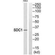 Western blot analysis of extracts from HeLa cells, using SDC1 antibody.