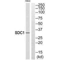 Western blot analysis of extracts from HeLa cells, using SDC1 antibody.