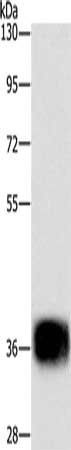 Gel: 10%SDS-PAGE, Lysate: 40 ug, Lane: Mouse heart tissue, Primary antibody: CSB-PA046028(CEBPE Antibody) at dilution 1/500, Secondary antibody: Goat anti rabbit IgG at 1/8000 dilution, Exposure time: 5 seconds