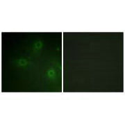 Immunofluorescence analysis of HeLa cells, using Neutrophil Cytosol Factor 1 (Ab-304) antibody.