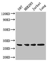 Western Blot Positive WB detected in: U87 whole cell lysate, HEK293 whole cell lysate, Jurkat whole cell lysate, Mouse lung tissue All lanes: LASP1 antibody at 4ug/ml Secondary Goat polyclonal to rabbit IgG at 1/50000 dilution Predicted band size:...