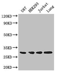 Western Blot Positive WB detected in: U87 whole cell lysate, HEK293 whole cell lysate, Jurkat whole cell lysate, Mouse lung tissue All lanes: LASP1 antibody at 4ug/ml Secondary Goat polyclonal to rabbit IgG at 1/50000 dilution Predicted band size:...