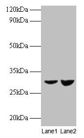 Western blot All lanes: UQCRFS1 antibody at 2µg/ml Lane 1: EC109 whole cell lysate Lane 2: 293T whole cell lysate Secondary Goat polyclonal to rabbit IgG at 1/15000 dilution Predicted band size: 30 kDa Observed band size: 30 kDa