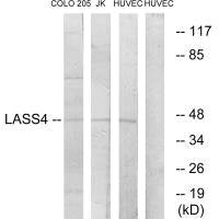 Western blot analysis of extracts from COLO cells, Jurkat cells and HUVEC cells, using LASS4 antibody.