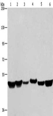 Gel: 8%SDS-PAGE, Lysate: 40 ug, Lane 1-6: LoVo cells, A375 cells, mouse brain tissue, HepG2 cells, A431 cells, Hela cells, Primary antibody: CSB-PA046570(HNRNPH1 Antibody) at dilution 1/350, Secondary antibody: Goat anti rabbit IgG at 1/8000 dilut...