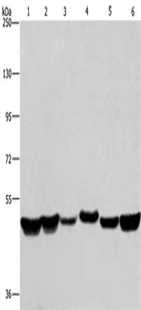 Gel: 8%SDS-PAGE, Lysate: 40 ug, Lane 1-6: LoVo cells, A375 cells, mouse brain tissue, HepG2 cells, A431 cells, Hela cells, Primary antibody: CSB-PA046570(HNRNPH1 Antibody) at dilution 1/350, Secondary antibody: Goat anti rabbit IgG at 1/8000 dilut...