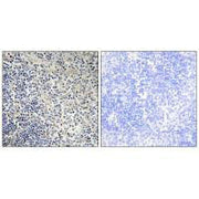 Immunohistochemistry analysis of paraffin-embedded human thymus gland tissue using TPIP1 antibody.