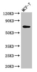 Western Blot Positive WB detected in: MCF-7 whole cell lysate All lanes: KARS antibody at 2.5µg/ml Secondary Goat polyclonal to rabbit IgG at 1/50000 dilution Predicted band size: 69, 72 kDa Observed band size: 69 kDa