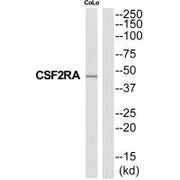Western blot analysis of extracts from COLO205 cells, using CSF2RA antibody.