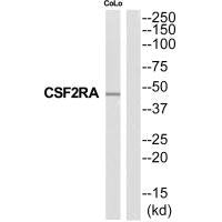 Western blot analysis of extracts from COLO205 cells, using CSF2RA antibody.