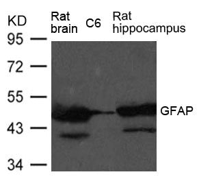 Western blot analysis of extract from Rat brain, Rat hippocampus tissue and C6 cells using GFAP Antibody