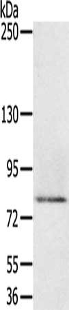 Gel: 6%SDS-PAGE, Lysate: 40 ug, Lane: Human rectum carcinoma tissue, Primary antibody: CSB-PA047131(MEP1A Antibody) at dilution 1/200, Secondary antibody: Goat anti rabbit IgG at 1/8000 dilution, Exposure time: 3 minutes