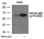 Western blot analysis of extracts from Hela cells untreated or treated with TNFa+CA using NFkB-p65(Phospho-Thr435) Antibody.