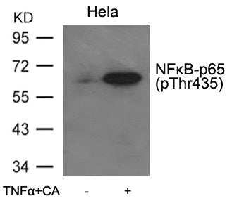 Western blot analysis of extracts from Hela cells untreated or treated with TNFa+CA using NFkB-p65(Phospho-Thr435) Antibody.