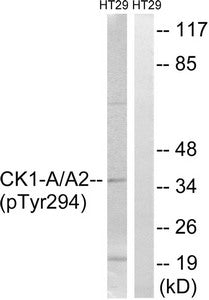Western blot analysis of extracts from HT-29 cells treated with heat shock using CK-1α (Phospho-Tyr294) Antibody.The lane on the right is treated with the antigen-specific peptide.