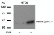 Western blot analysis of extracts from HT29 cells untreated or treated with PMA using Paxillin(Phospho-Tyr31) Antibody.
