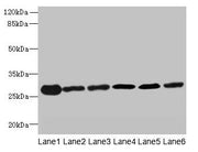 Western blot All lanes: TMED9 antibody at 4.5µg/ml Lane 1: Mouse liver tissue Lane 2: Mouse kidney tissue Lane 3: Human placenta tissue Lane 4: A549 whole cell lysate Lane 5: MCF-7 whole cell lysate Lane 6: A431 whole cell lysate Secondary Goat po...