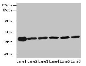 Western blot All lanes: TMED9 antibody at 4.5µg/ml Lane 1: Mouse liver tissue Lane 2: Mouse kidney tissue Lane 3: Human placenta tissue Lane 4: A549 whole cell lysate Lane 5: MCF-7 whole cell lysate Lane 6: A431 whole cell lysate Secondary Goat po...