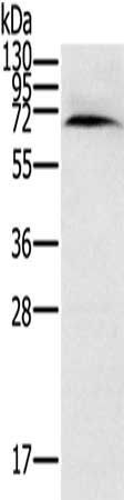 Gel: 8%SDS-PAGE, Lysate: 40 ug, Lane: Human normal kidney tissue, Primary antibody: CSB-PA048582(CYP11A1 Antibody) at dilution 1/200, Secondary antibody: Goat anti rabbit IgG at 1/8000 dilution, Exposure time: 5 minutes