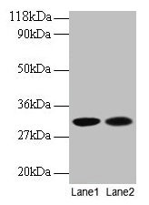 Western blot All lanes: MRPL9 antibody at 2µg/ml Lane 1: EC109 whole cell lysate Lane 2: 293T whole cell lysate Secondary Goat polyclonal to rabbit IgG at 1/15000 dilution Predicted band size: 31 kDa Observed band size: 31 kDa