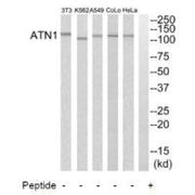 Western blot analysis of extracts from HeLa cells, A549 cells, K562 cells, COLO205 cells and NIH-3T3 cells, using ATN1 antibody.