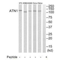 Western blot analysis of extracts from HeLa cells, A549 cells, K562 cells, COLO205 cells and NIH-3T3 cells, using ATN1 antibody.