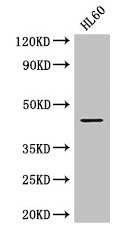 Western Blot Positive WB detected in: HL60 whole cell lysate All lanes: MAP2K2 antibody at 2.8µg/ml Secondary Goat polyclonal to rabbit IgG at 1/50000 dilution Predicted band size: 45 kDa Observed band size: 45 kDa