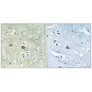 Immunohistochemistry analysis of paraffin-embedded human brain tissue using NDUFV3 antibody.