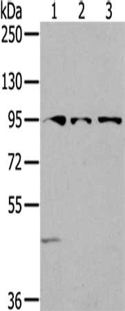 Gel: 6%SDS-PAGE,Lysate: 40 ug,Lane 1-3: 293T cells, Lovo cells, HepG2 cells,Primary antibody: CSB-PA049485(SEMA6A Antibody) at dilution 1/200 dilution,Secondary antibody: Goat anti rabbit IgG at 1/8000 dilution,Exposure time: 2 minutes