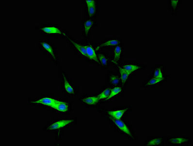 Immunofluorescent analysis of Hela cells using CSB-PA04949A0Rb at dilution of 1:100 and Alexa Fluor 488-congugated AffiniPure Goat Anti-Rabbit IgG(H+L)