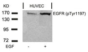 Western blot analysis of extracts from HUVEC cells untreated or treated with EGF using EGFR(Phospho-Tyr1197) Antibody.