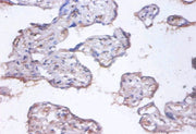 Immunohistochemistry of paraffin-embedded human placenta tissue using CSB-PA04965A0Rb at dilution of 1:100